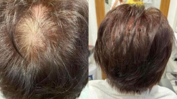 invisible hair extensions combline in saffron walden invisible hair extensions combline in saffron walden